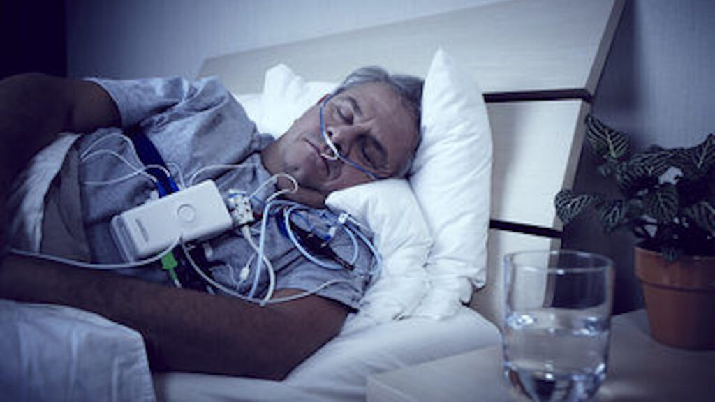 Sleep Apnea Test Canberra